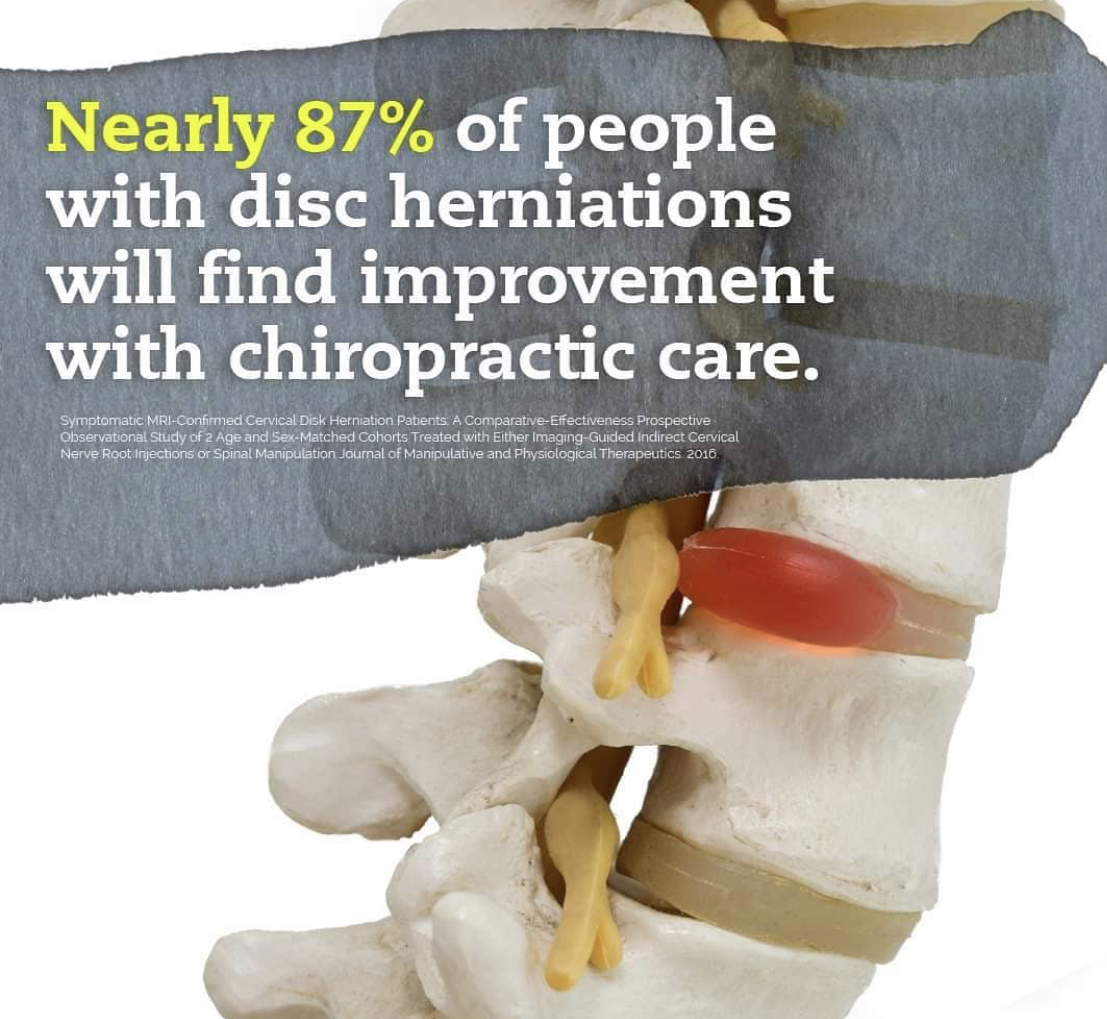 Most people find improvement with chiropractic care